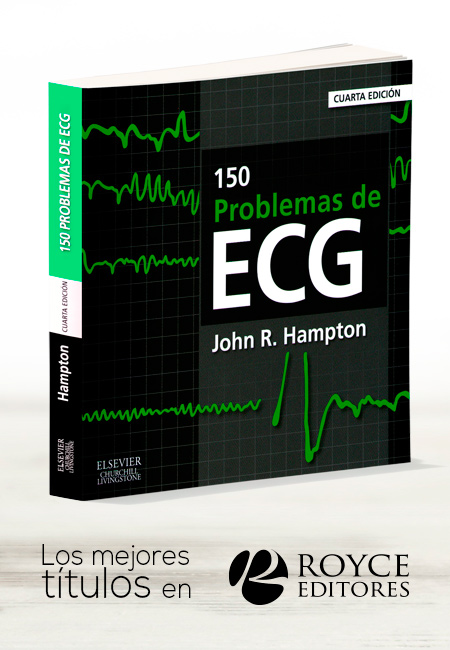 Compra en línea 150 Problemas de ECG