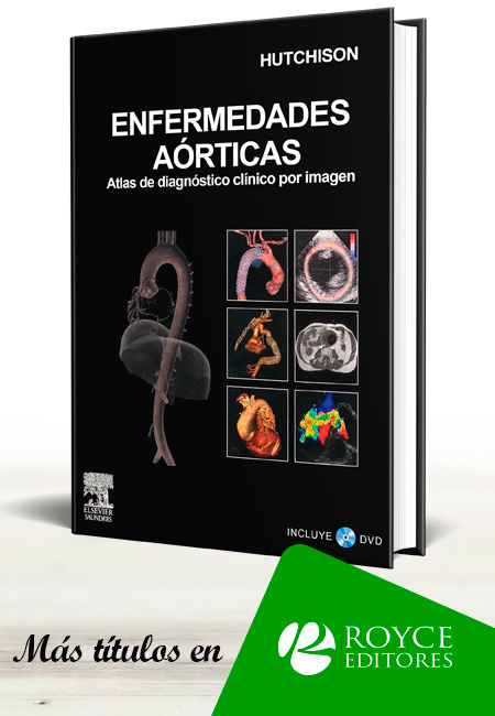 Compra en línea Enfermedades Aórticas: Atlas de Diagnóstico Clínico por Imagen