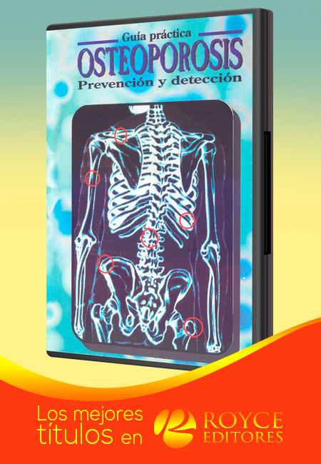 Compra en línea Guía Práctica OSTEOPOROSIS Prevención y Detección