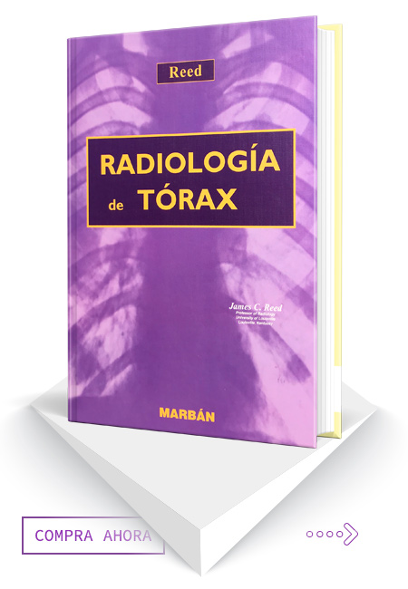Compra en línea Radiología de Tórax
